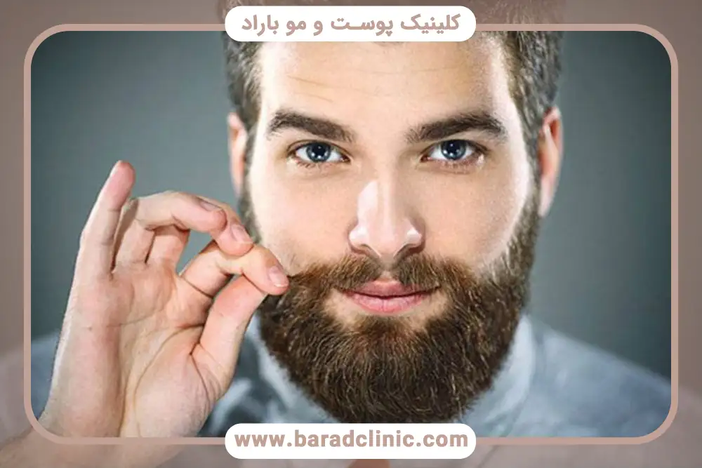 کاشت ریش و سبیل در تهران؛ تفاوتها و نکات مهم