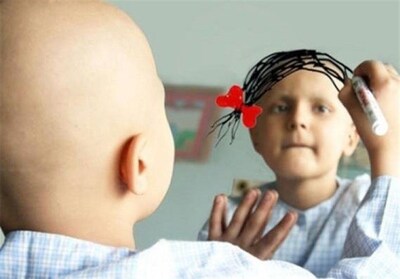 معاون درمان وزارت بهداشت بر لزوم تهیه بسته‌های حمایتی برای بیماران خاص تأکید کرد.